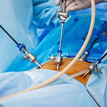 general and laparoscopic surgery
